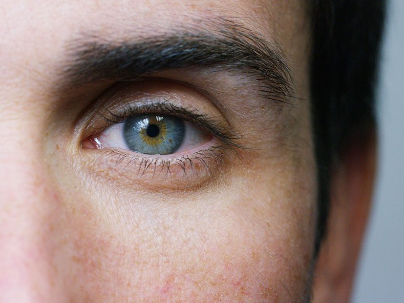 Eyelid Repairs